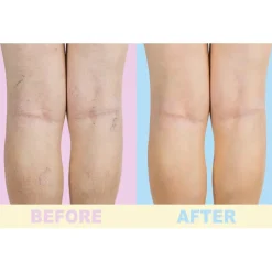 Outlet Tempsl Gel soin des jambes