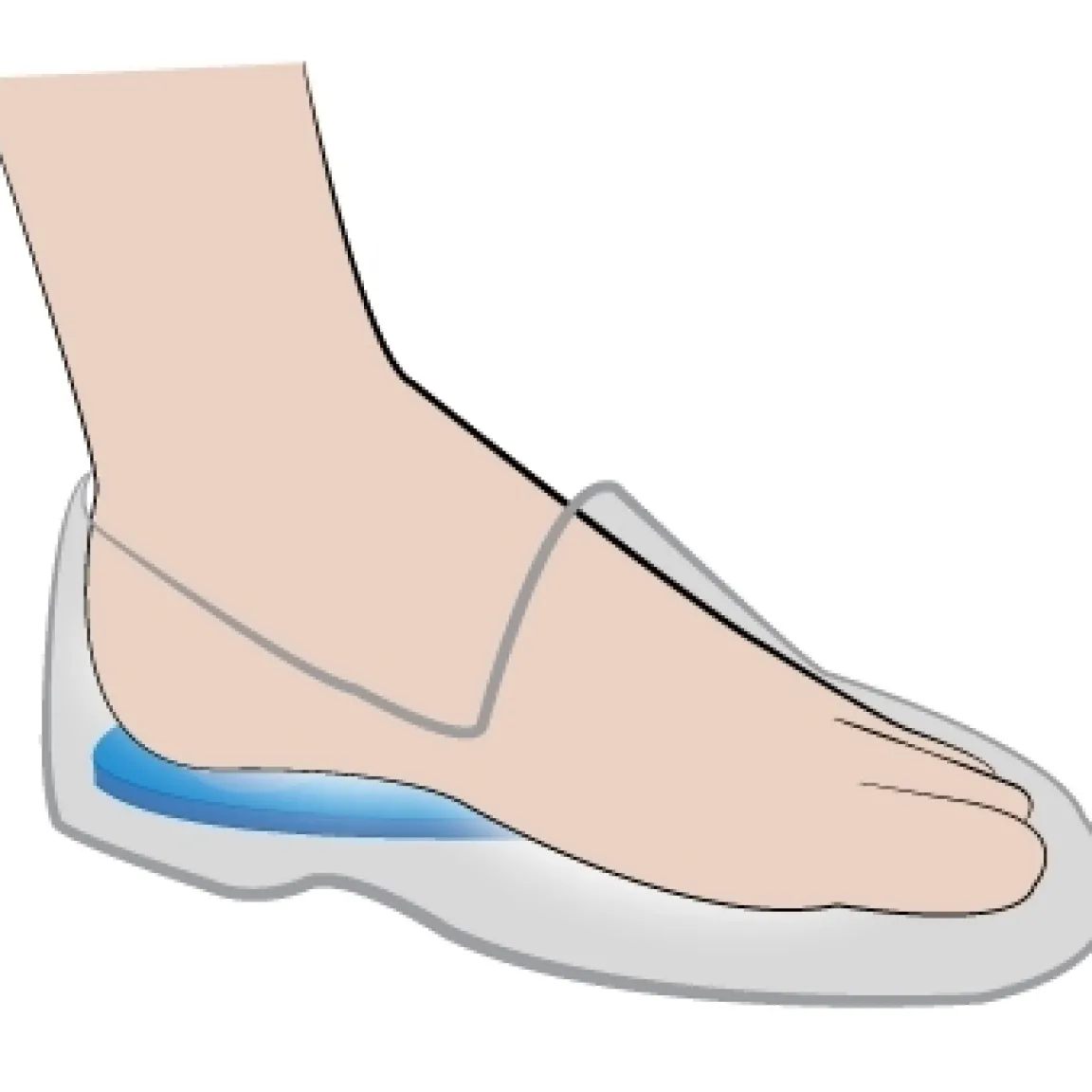 New Tempsl Talonnettes pour épine calcanéenne Modèle femme