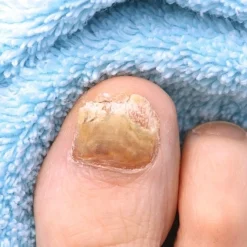 New Tempsl Teinture pour Onyxis Titania®, 10 ml